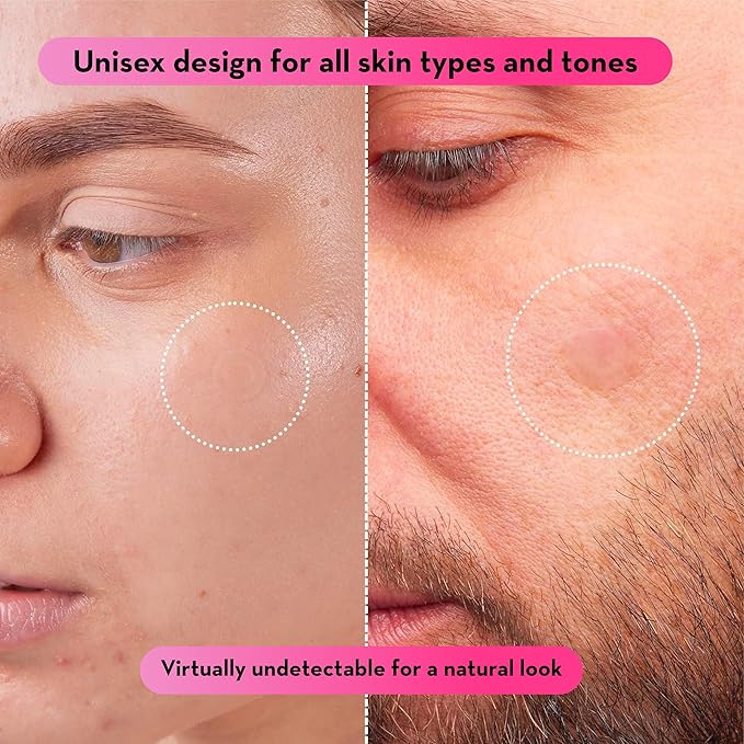 grace & stella Pimple Patches for Face (132 dots) - Hydrocolloid Acne Patch for Zits and Blemishes - Invisible Blemish Patches for Face - Spot Cover Stickers