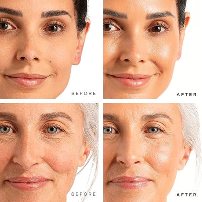 Tree of Life Beauty Facial Skin Care Set, Brightening, Firming, Hydrating, Dry Face, Dermatologist Tested - Vitamin C Serum (Brightens) + Retinol Serum (Smooths) - Skin Care Kit, 2 count of 1 Fl Oz